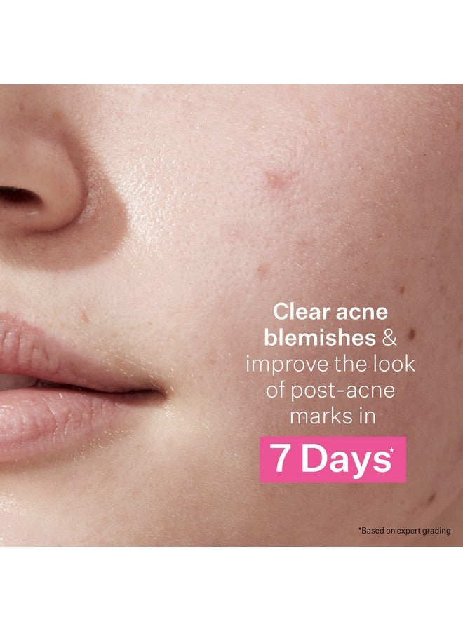 Strivectin Multiaction Clear: 30 Day Trial Kit Acne Control System For Breakouts And Blemishes 3 Piece Set - Image 5