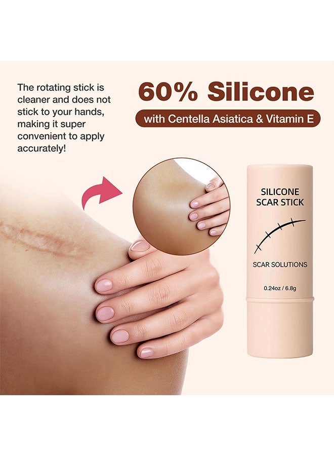 OCHEAL Silicone Scar Stick, 60% Silicone Scar Solutions for Face and Body, with Centella Asiatica & Vitamin E, Soothing & Moisturizing Scar Treatment for Old & New Scars - Image 2