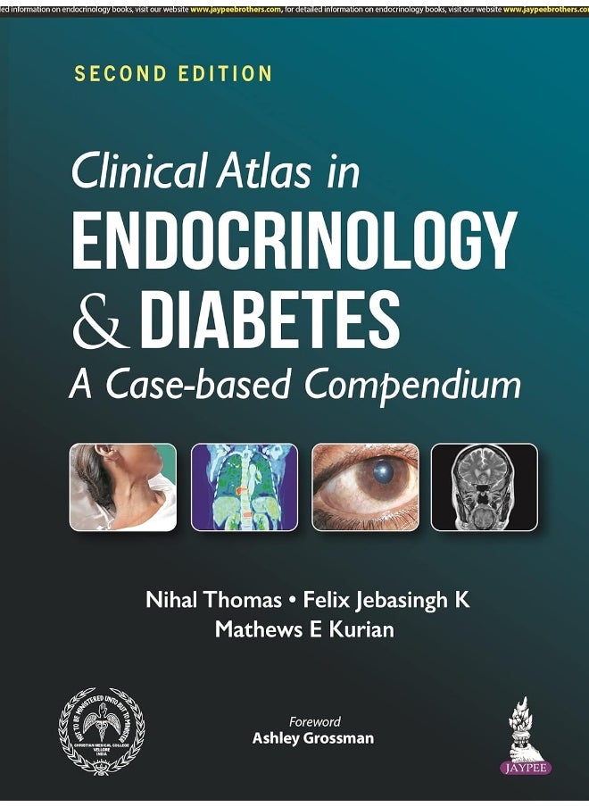 Clinical Atlas in Endocrinology and Diabetes: A Case-based Compendium 