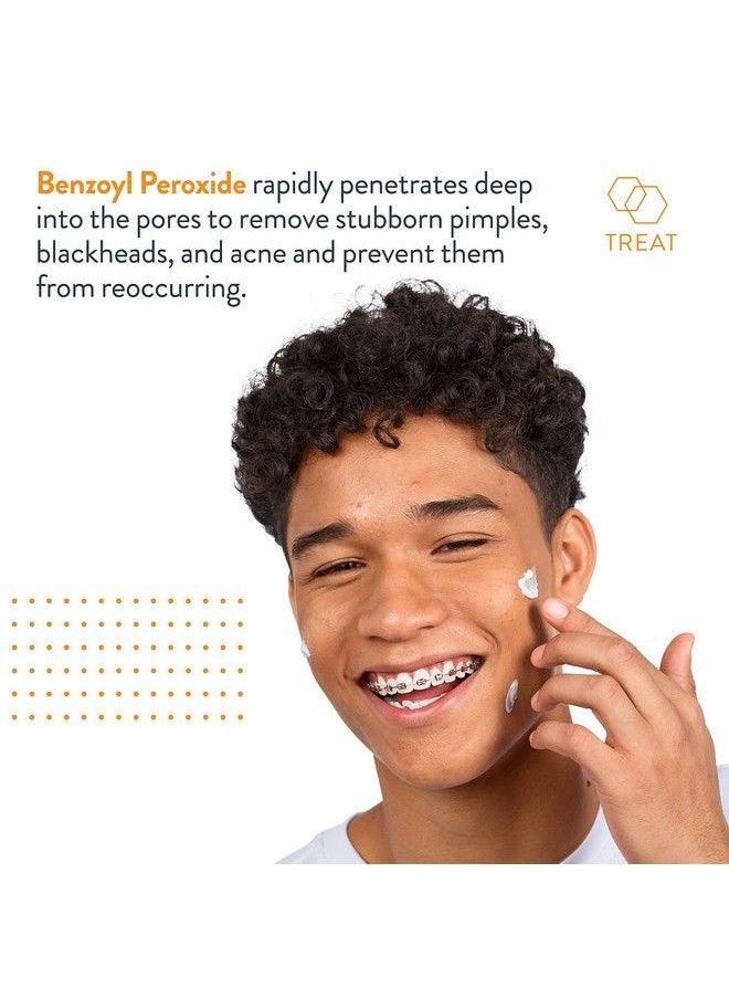 AcneFree - Terminator 10 Acne Spot Treatment With Benzoyl Peroxide 10% Maximum Strength Acne Cream Treatment 1 Ounce Pack Of 1 - Image 1