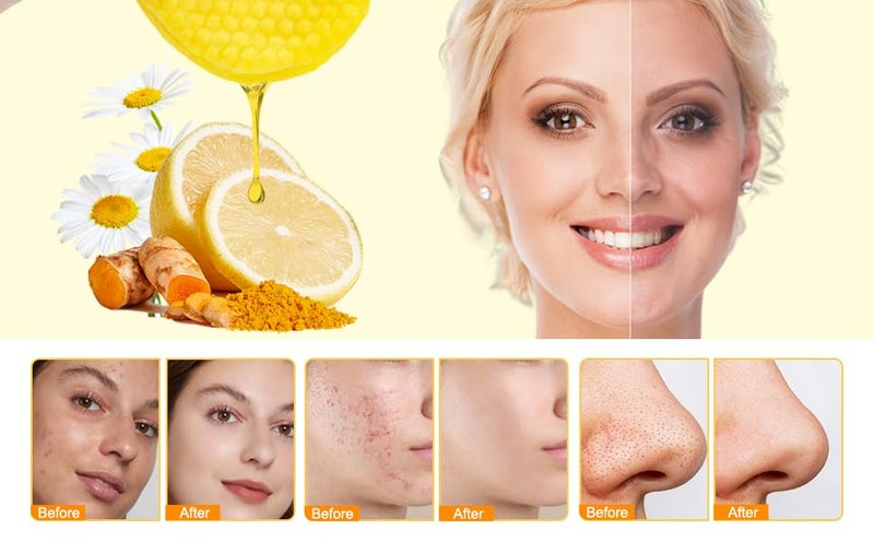 RIVIOX Kojic Acid And Turmeric Cleansing Pads (60 Count), Turmeric Kojic Acid Cleansing Pads For Face Mild & Non-Irritating, Helps Balance Skin Oil & Water, Gentle & Non-Irritating For All Skin Types - Image 2