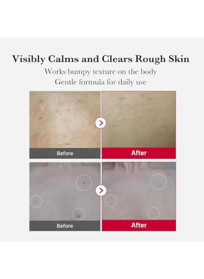 Red Body Peeling Shot, Strawberry Skin Body Spray Cleanser, AHA + BHA + Succinic Acid, Exfoliating, 3.88 oz. - Image 3