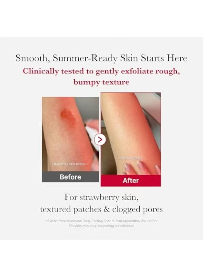 Red Body Peeling Shot, Strawberry Skin Body Spray Cleanser, AHA + BHA + Succinic Acid, Exfoliating, 3.88 oz. - Image 2