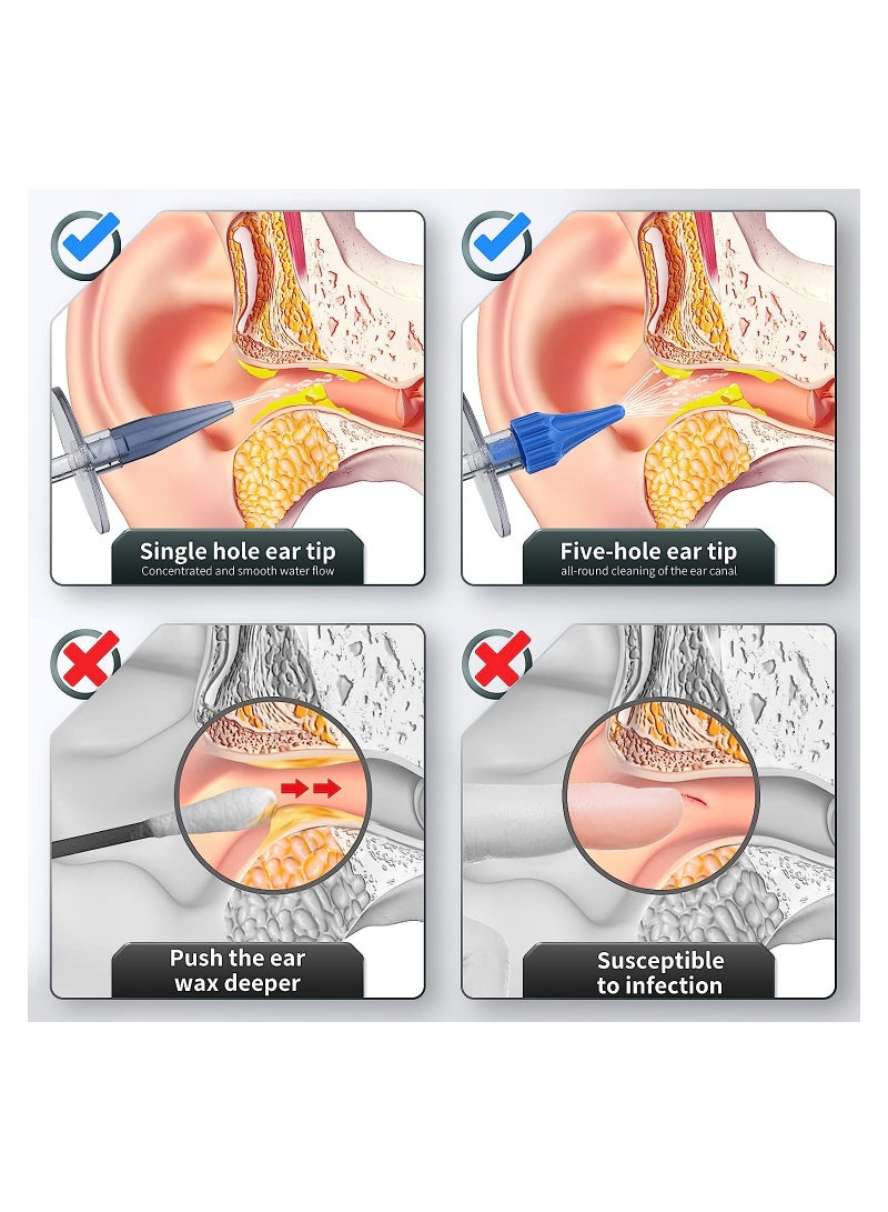 SYOSI Ear Wax Removal Manual Ear Irrigation Flushing System Safe and Effective Ear Cleaner Ear Cleaning Kit for Adults Kids Ear Wax Removal kit Includes Basin Towel & 31 Tips  - Image 4