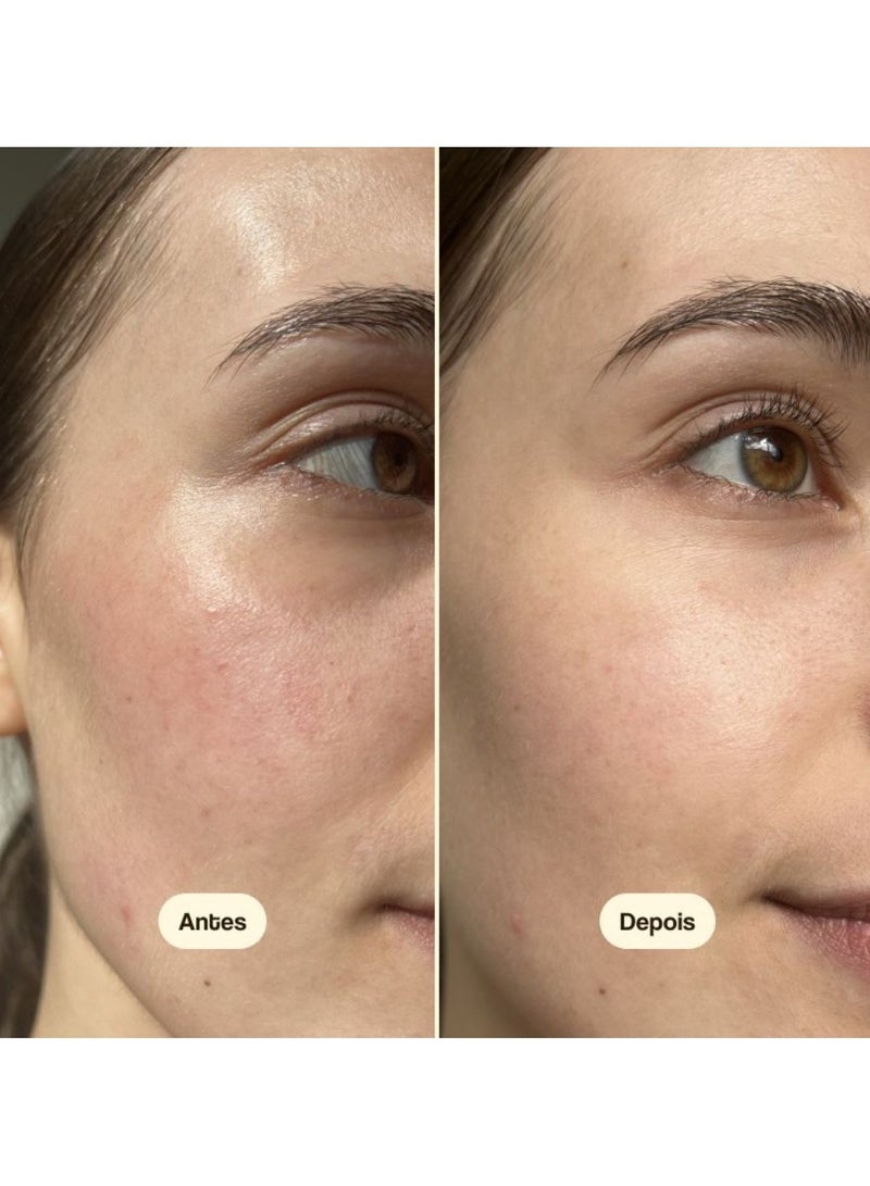 فريشلي كريم ترطيب فريشلي سيكا كالم للبشرة الجافة والحساسة 50 مل - Image 3