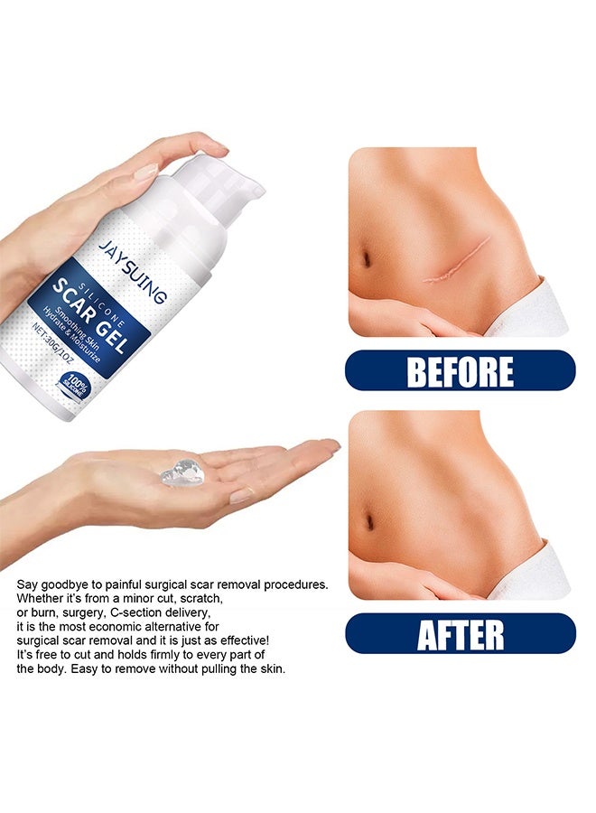 Jaysuing Silicone Scar Gel 30g Scar Cream, Scar Removal, Scar Treatment, Scar Removal Cream for C-Section, Stretch Marks, Acne, Surgery, Effective for Both Old and New Scars  - Image 4