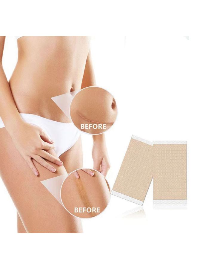 Horse Scar Patch Hyperplasia Raised Softening Caesarean Section Repair Light Scar Light Scar Waterproof Concealer Scar Patch - Image 2