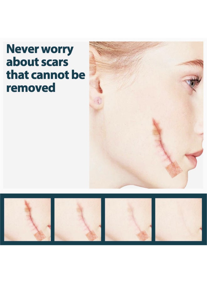 Horse Scar Patch Hyperplasia Raised Softening Caesarean Section Repair Light Scar Light Scar Waterproof Concealer Scar Patch - Image 4
