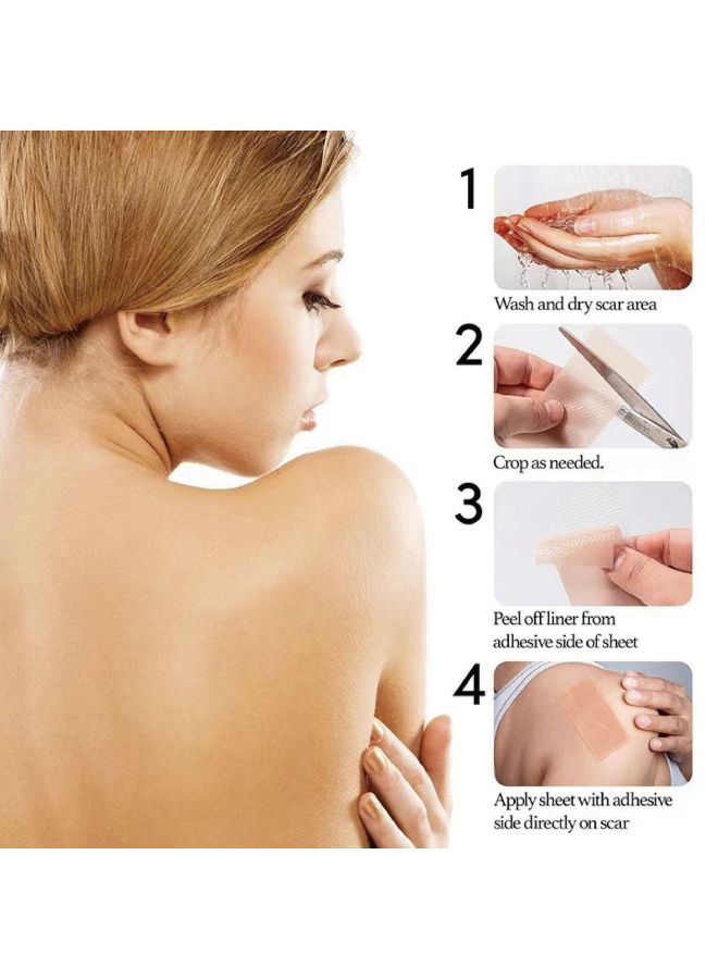 Horse Scar Patch Hyperplasia Raised Softening Caesarean Section Repair Light Scar Light Scar Waterproof Concealer Scar Patch - Image 3