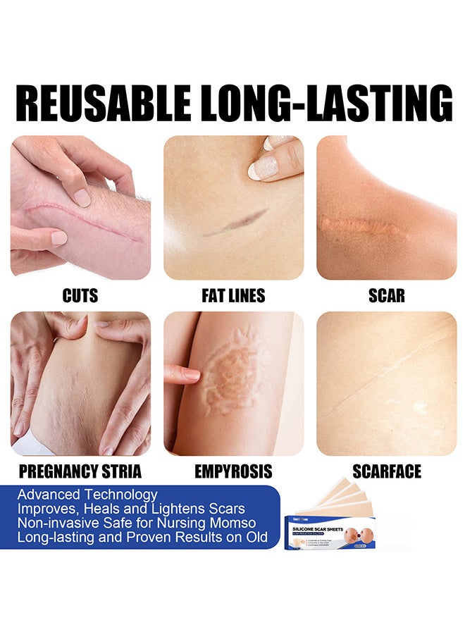 SOUTH MOON Scar Remover Patch, Silicone Scar Sheets For Scars Stretch Mark Treatment Waterproof, 4 Reusable Sheets, Size 5.9" x 1.6"  - Image 5