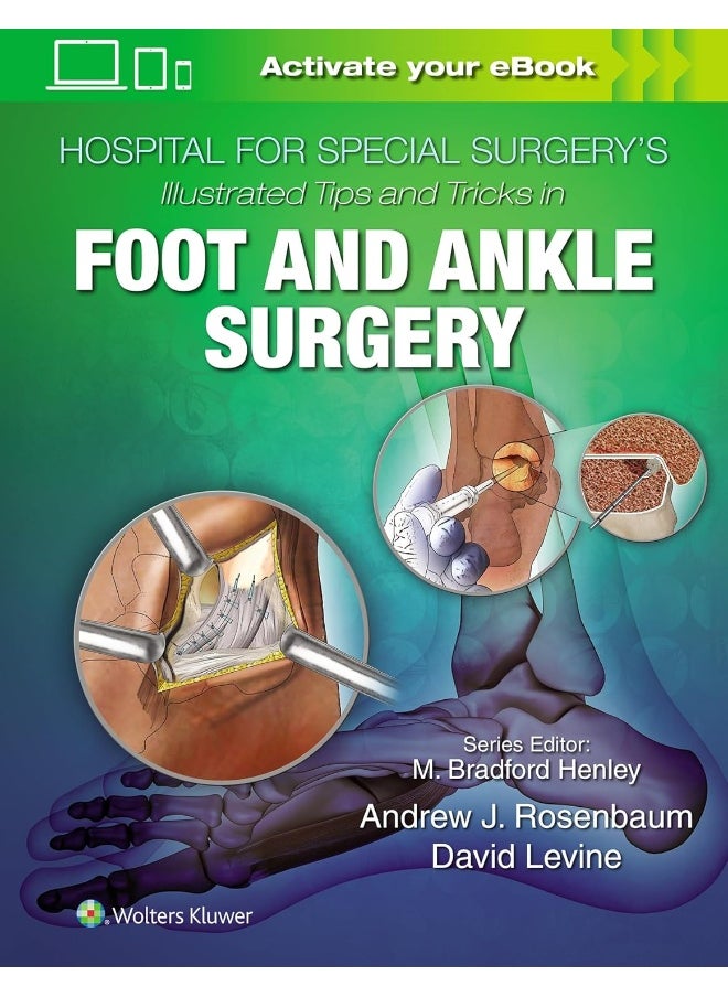 Hospital for Special Surgery's Illustrated Tips and Tricks in Foot and Ankle Surgery 