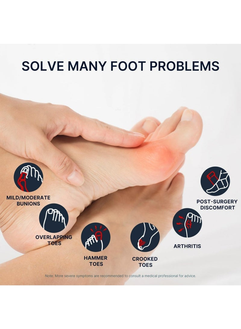 YOUGE A Pair Bunion Corrector Splints Women & Men Big Toe - Adjustable Big Toe Separator for Pain Relief - Adjustable Bunion Correction Orthopedic for Hallux Valgus - Day & Night Support - Image 4