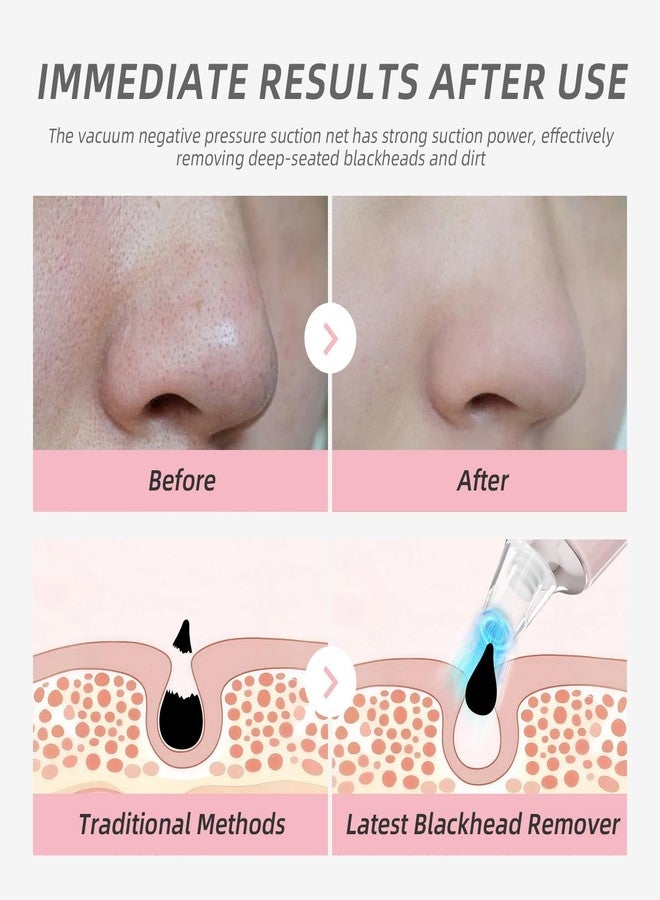 Blackhead Remover Pore Vacuum, Face Cleaner Extractor, 4 Suction Heads & 3 Adjustable Modes, USB Charging Interface, Blackhead Vacuum Kit for Women&Men(Pink) - Image 3