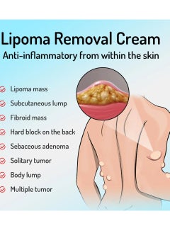 SOUTH MOON Lipoma Cream Lump Free Lipoma Removal Cream Herbal Lipoma Lumps Removal and Nodular Discomfort Ointment Reduce Fatty Lumps Easy to Absorb Safe and Effective Lipoma Treatment 20g  - Image 3