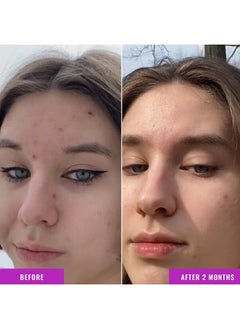 GOOD MOLECULES Good Molecules Niacinamide Serum - 10% Niacinamide Balancing B3 Facial Serum for Acne, Tone, Texture - Brightening and Hydrating Skincare for Face  - Image 4