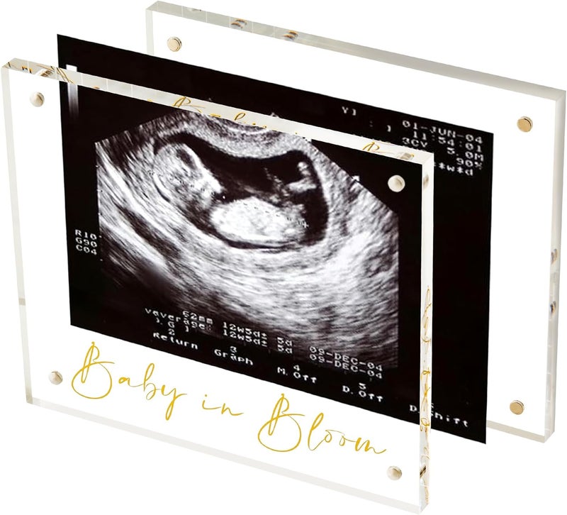 Calculs Baby US Frame Baby in Bloom Ultrasound Sonogram Keepsake Acrylic Picture Frame Freestanding Double Sided Magnetic Lucite Frameless Display Gifts for Her - Image 1
