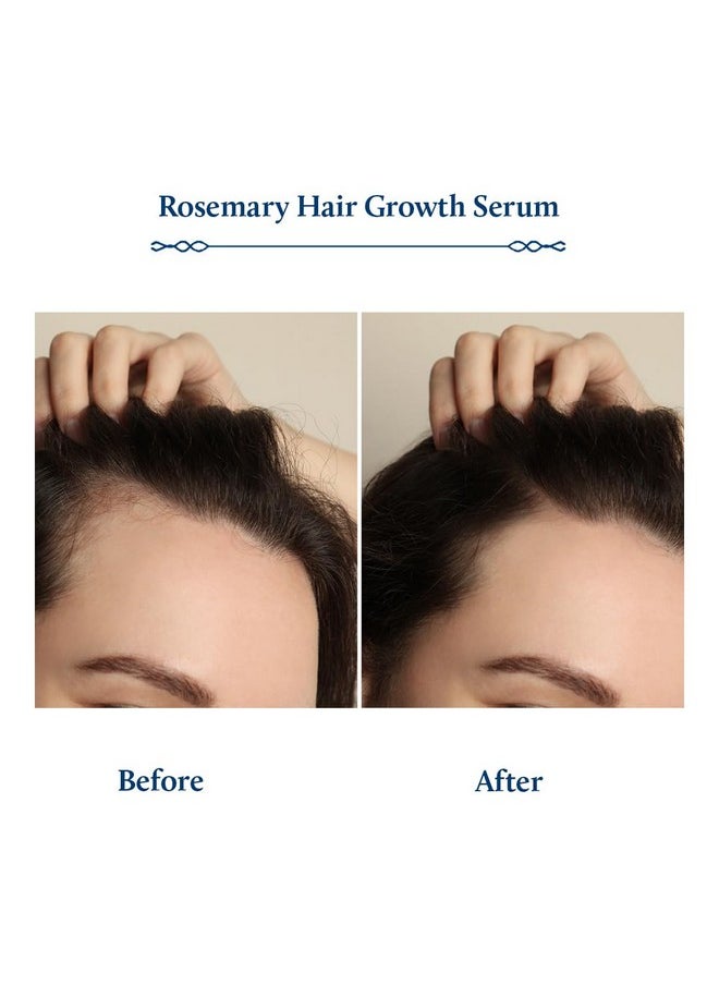 Blue Nectar Advanced Plant Based Rosemary Hair Growth Serum, Natural Alternate For Redensyl For Hair Growth | Intensive Ayurvedic Hair Serum For Women & Men For Healthy Hair & Scalp With Bhringraj (8 Herbs, 100 Ml)  - Image 4