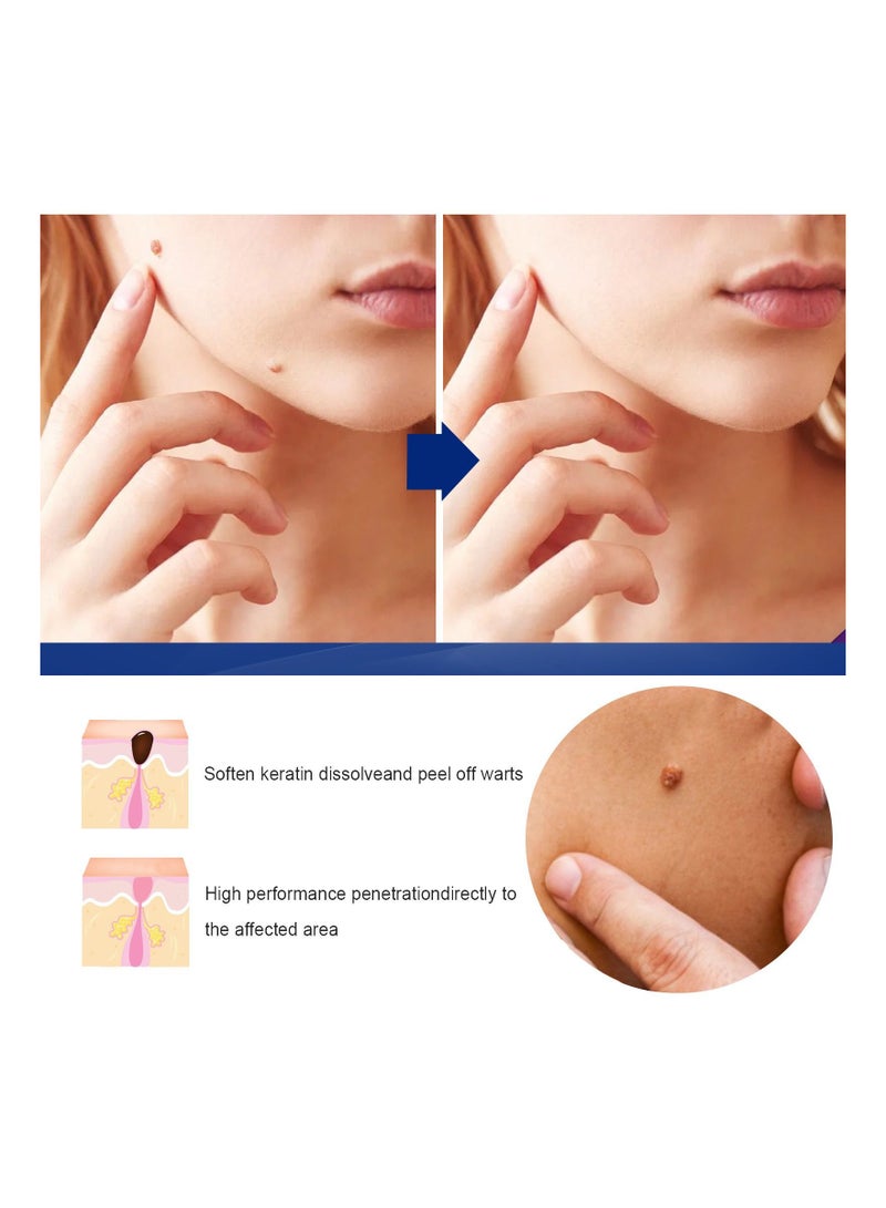 EELHOE 20g Warts Remover Cream Extract Skin Face Tag Extract Corn Treatment Ointment Painless For Men Women Childrens - Image 4