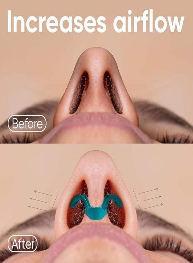 Digital Shoppy Anti‑Snore Nose Clip - Improve Airflow | Comfortable Nasal Breathing Aid - Image 3