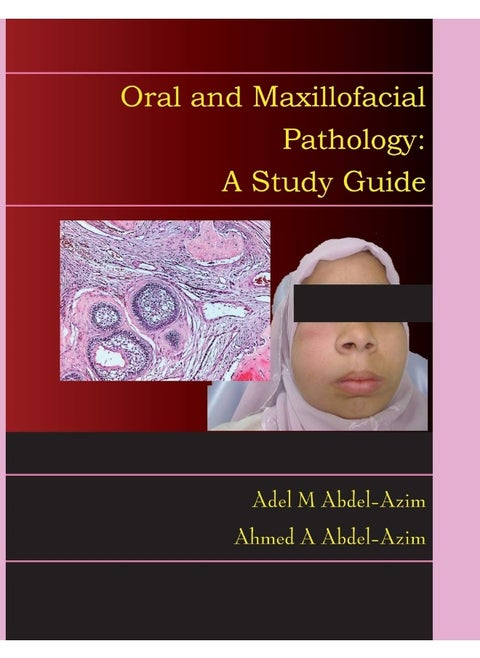 Oral and Maxillofacial Pathology: A Study Guide