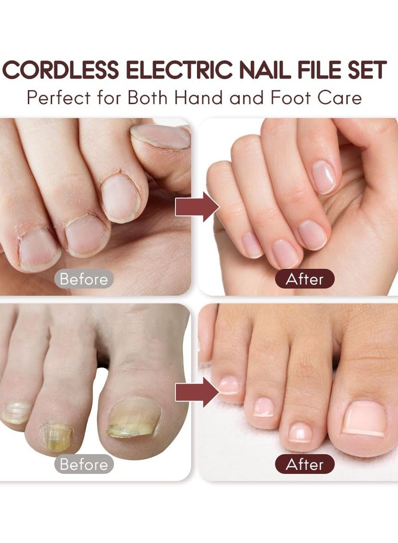 general Professional Manicure Pedicure Kit, Cordless Electric Nail File Set, Rechargeable Pedicure Tools for feet, 5 Speeds Hand Foot Care Nail Drill for Thick Nail Toenail Cuticle Women Men Baby Pets - Image 5