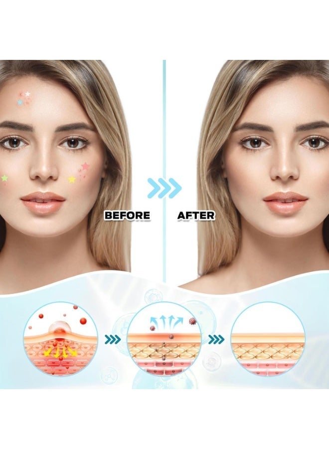 Jaysuing 200 Pcs Pimple Patches Hydrocolloid Non Drying Acne Patches for Face Colorful Heart Pimple Spot Sticker with Hyaluronic Acid Tea Tree Oil and Centella Oil STAR ACNE PATCHESfor Covering Blemishes and Zits - Image 2