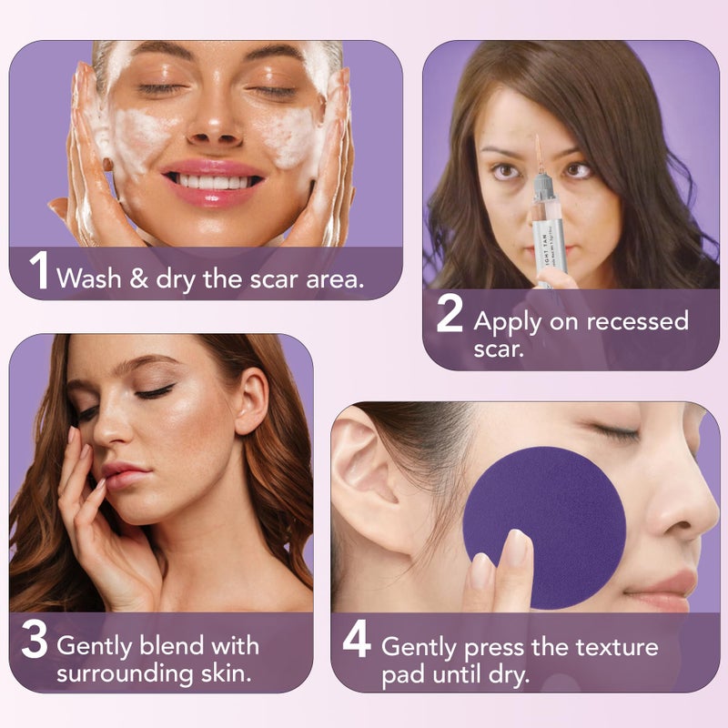 dermaflage مجموعة ملء الندبات ديرمافلاج - تان فاتح - تغطية الندبات العميقة وكريم أساس مقاوم للماء لندبات حب الشباب والتجاعيد وندبات الثلج، إمداد لمدة 1 شهر - Image 4