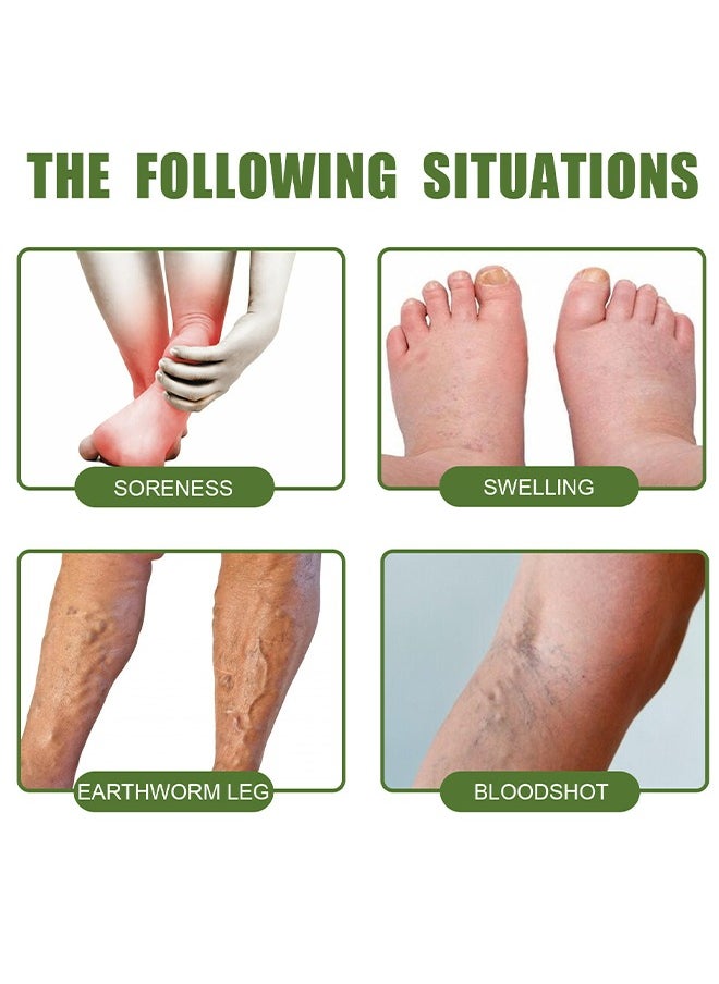 SOUTH MOON Instant Relief Varicose Vein - Soothing Leg Cream, Varicose And Spider Veins Treatment Cream, Improve Blood Circulation, Fast Relieve Swelling Pain 50G  - Image 2