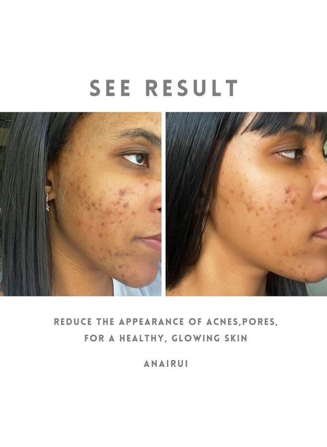 ANAI RUI Turmeric Vitamin C Face Mask For Dark Spots Kaolin Clay Mask With Vitamin C E And Aloe Skin Care Turmeric Clay Mask For Acne & Refineing Pores Smooth & Radiant Skin 4.23 Oz - Image 5