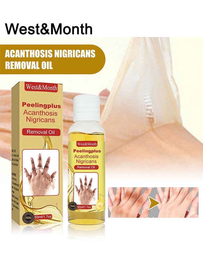 West&Month Peeling Plus-Acanthosis NigricansRremoval Oil,Dark Spot Corrector Oil, Acanthosis Nigricans Treatment For Dark Knuckle Finger Elbow And Knee Removal 50ML - Image 1