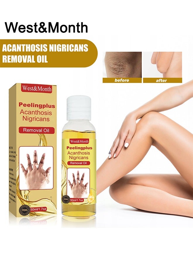 West&Month Peeling Plus-Acanthosis NigricansRremoval Oil,Dark Spot Corrector Oil, Acanthosis Nigricans Treatment For Dark Knuckle Finger Elbow And Knee Removal 50ML - Image 2