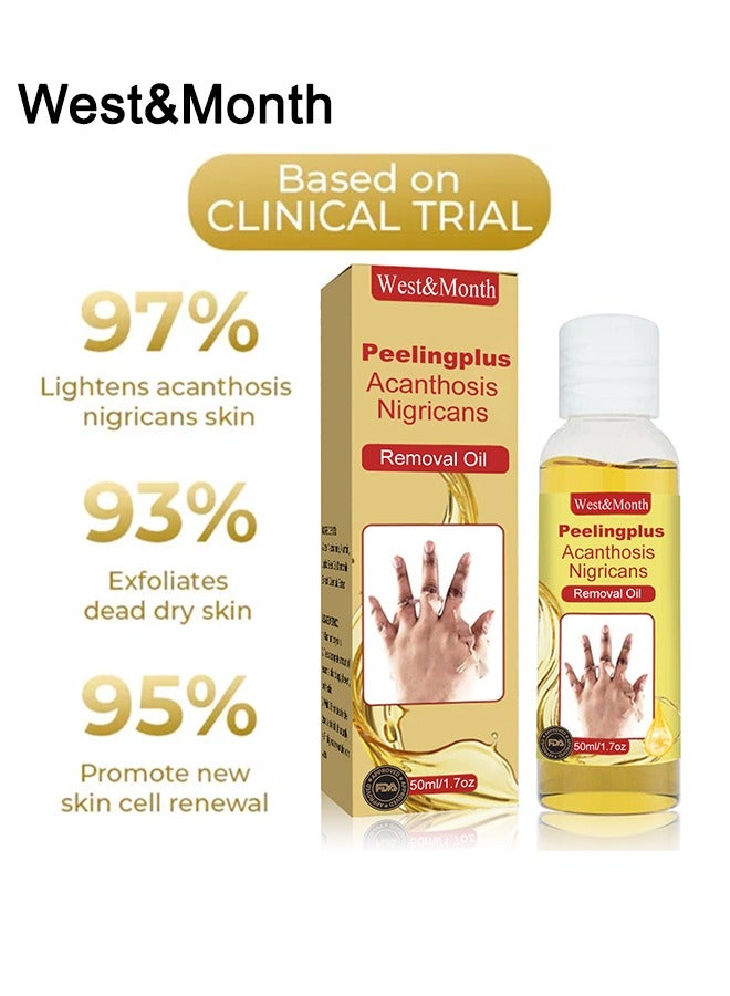 West&Month Peeling Plus-Acanthosis NigricansRremoval Oil,Dark Spot Corrector Oil, Acanthosis Nigricans Treatment For Dark Knuckle Finger Elbow And Knee Removal 50ML - Image 5