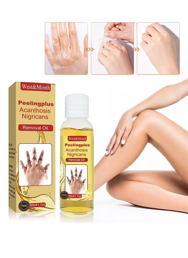West&Month - Peeling Plus-Acanthosis NigricansRremoval Oil,Dark Spot Corrector Oil, Acanthosis Nigricans Treatment For Dark Knuckle Finger Elbow And Knee Removal 50ML - Image 1