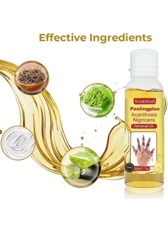 West&Month - Peeling Plus-Acanthosis NigricansRremoval Oil,Dark Spot Corrector Oil, Acanthosis Nigricans Treatment For Dark Knuckle Finger Elbow And Knee Removal 50ML - Image 1