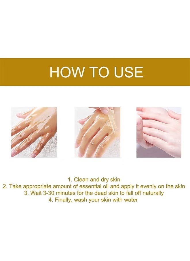 West&Month - Peeling Plus-Acanthosis NigricansRremoval Oil,Dark Spot Corrector Oil, Acanthosis Nigricans Treatment For Dark Knuckle Finger Elbow And Knee Removal 50ML - Image 1