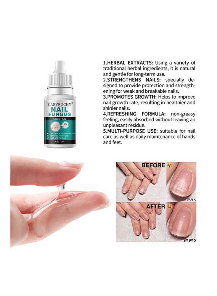 CARVENCHY Nail Fungus Solution-Fixes Discolored Nails, Safe & Effective - Anti Fungus Oil for Ingrown Toenails - Image 4