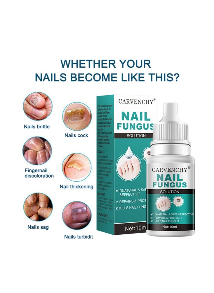 CARVENCHY Nail Fungus Solution-Fixes Discolored Nails, Safe & Effective - Anti Fungus Oil for Ingrown Toenails - Image 2