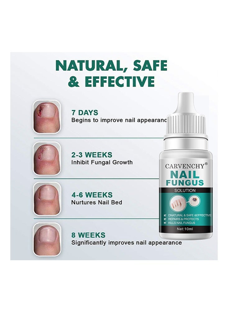 CARVENCHY Nail Fungus Solution-Fixes Discolored Nails, Safe & Effective - Anti Fungus Oil for Ingrown Toenails - Image 5