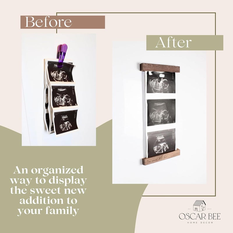 Oscar Bee Baby sonogram photo frame, magnetic poster frame for Pregnancy Announcements Ideas Baby Gender Reveal Gifts - Love At First Heartbeat Sonogram Picture Frame for Standard 5" x 7" Ultrasound - Image 4