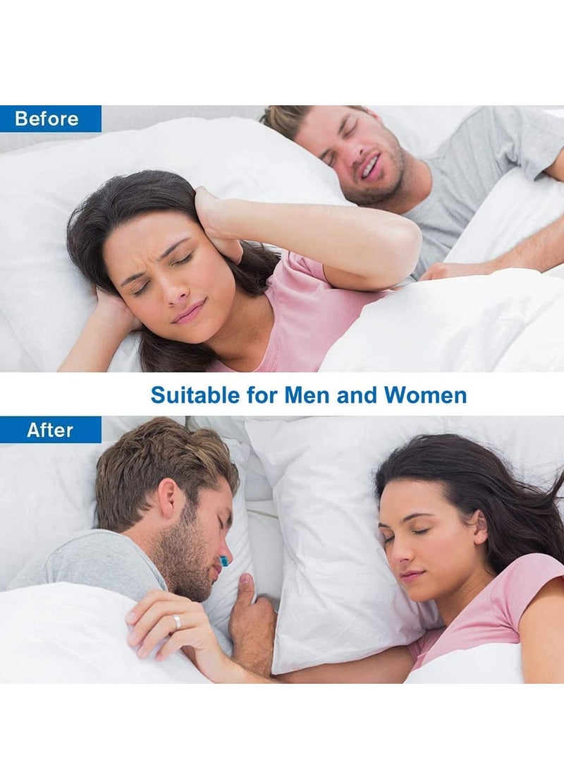 SOLARAE Anti Snoring Devices Solution Stopper Nose Vent Clip Air Purifier- Blue - Image 3