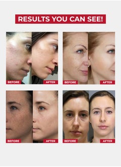 Face Fresh Set of 12 Gold Plus Beauty Serum - Vitamin B3 & Alpha Arbutin, Anti-aging, Prevents Dryness, Protects Skin from Damage & Fights Acne, For All Skin Types 3ml  - Image 2