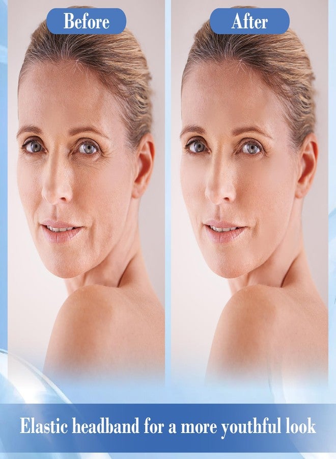 EKIND Reusable Face Lifting Band with Clips Patch Straps Adjustable Hairpin Invisible Facial Contour Belt for Facial Wrinkles Saggy Skin(Dual Strap,Black) - Image 5