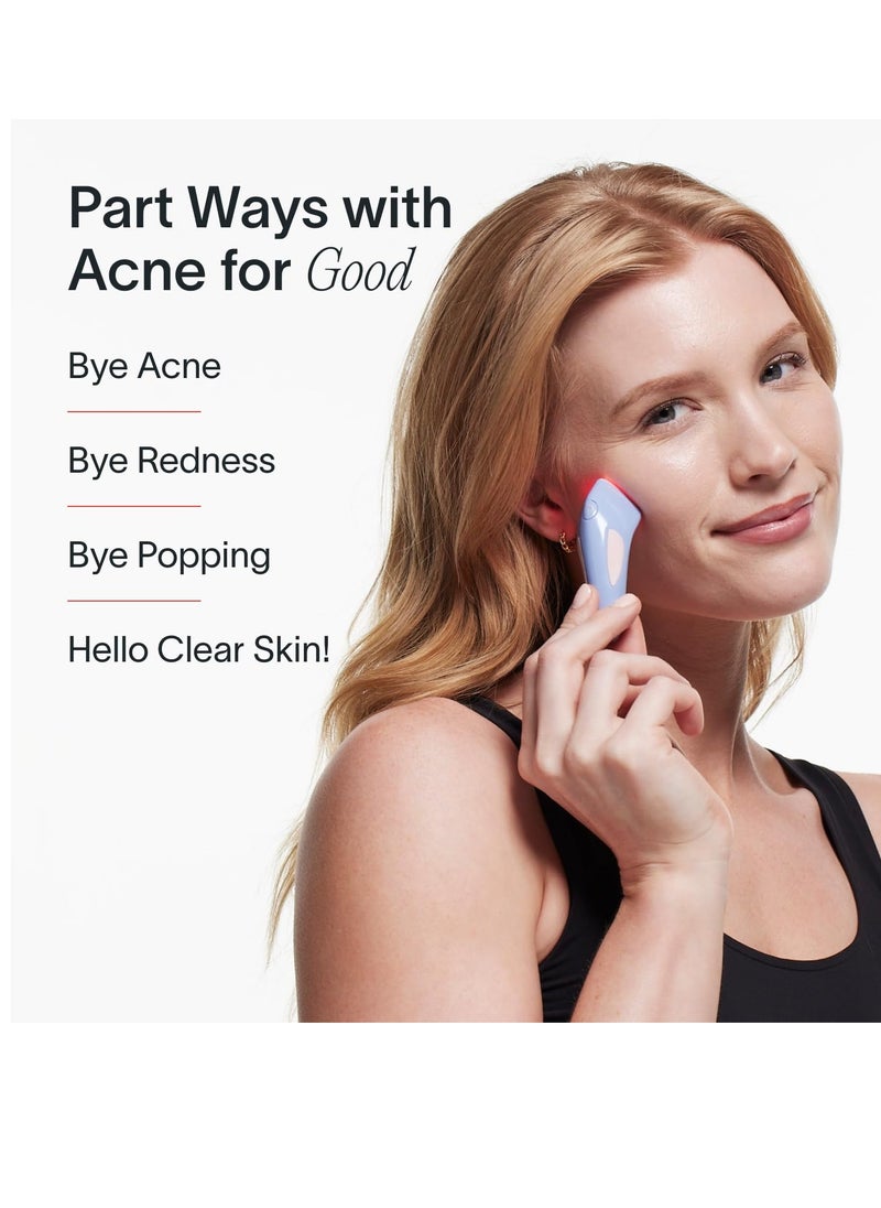 SOLAWAVE - Solawave Bye Acne Spot Treatment | Premium Pimple Red Light Therapy & Blue Light Recovery | Use Before Pimple Patches | Acne Care Light Device | Face Care Must-Have | Solawave Original - Image 1