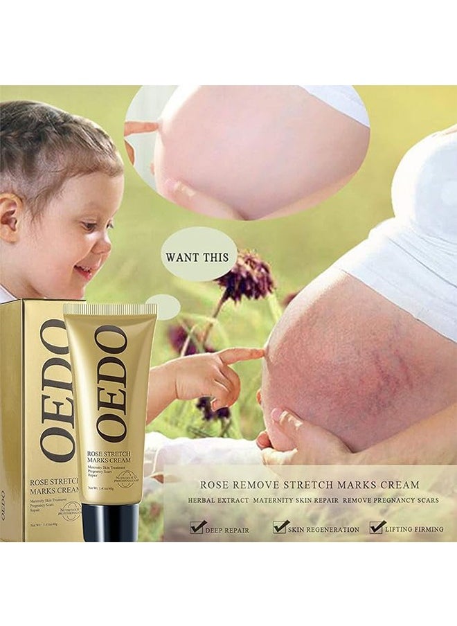 OEDO - Rose Remove Stretch Marks Cream Natural Plant Essence Formula Maternity Skin Treatmentpregnancy Scarsrepair Cream 40g - Image 1