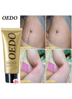Rose Remove Stretch Marks Cream Natural Plant Essence Formula Maternity Skin Treatmentpregnancy Scarsrepair Cream 40g