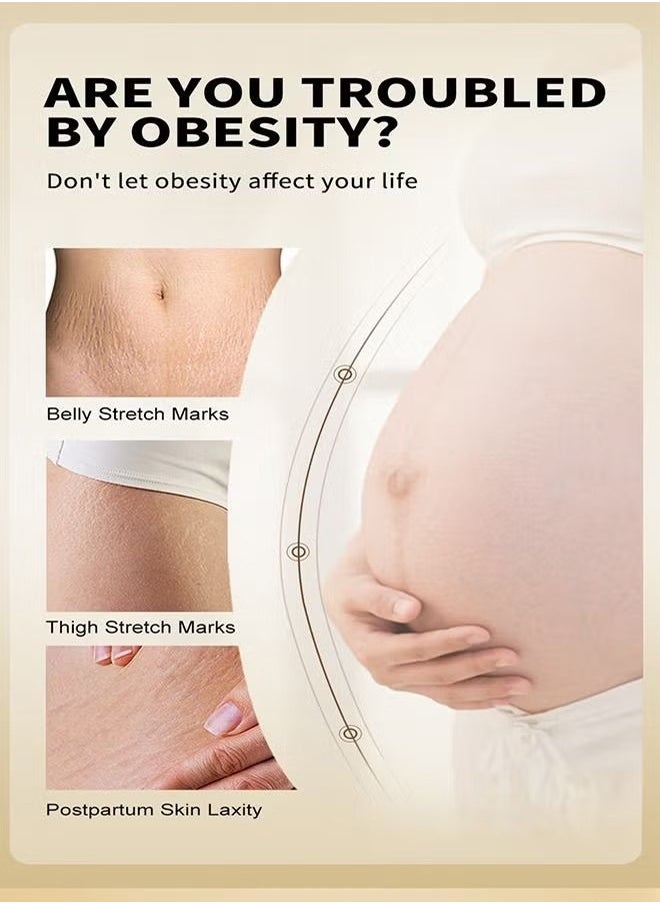 OEDO - Rose Remove Stretch Marks Cream Natural Plant Essence Formula Maternity Skin Treatmentpregnancy Scarsrepair Cream 40g - Image 1