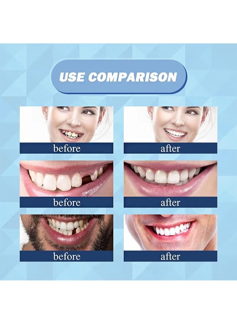 Composite Resin Teeth，28 Pieces False Teeth，Whole Teeth Synthetic Polymer Denture Teeth，23 Shade A2 Upper + Lower Dental Materials for Replacement - Image 4