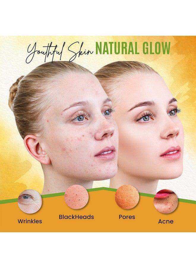 dermaxgen Organic Turmeric Face Mask Detox Clay For Clear Radiant Skin Acne & Scars Reduction Healing Clay Pore Cleansing Facial Mask Improve Skin Tone And Texture Allnatural 5.29Fl Oz - Image 4