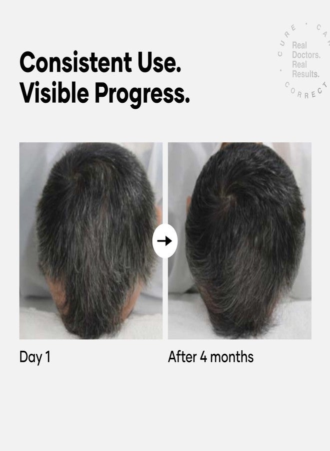 Cureskin سيروم كيورسكين المضاد للشيب | يقلل الشيب تدريجياً في الرأس واللحية بدون صبغة | يعيد لون الشعر الطبيعي بفضل الببتيد-52 | خالٍ من البيروكسيد والأمونيا، 60 مل (عبوة واحدة) - Image 3
