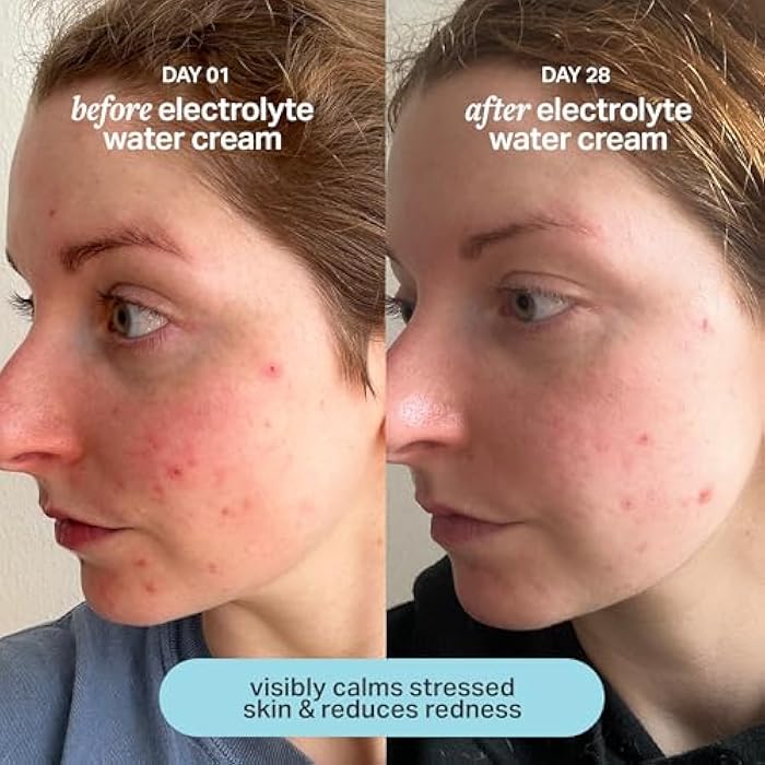 Cocokind Electrolyte Water Cream | Lightweight Water Gel Moisturizer | Balanced Hydrating Day Cream for All Skin Types | 1.7 Fl Oz - Image 4